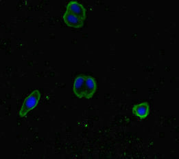 Immunofluorescent analysis of HepG2 cells using SNX14 Antibody at dilution of 1:100 and Alexa Fluor 488-congugated AffiniPure Goat Anti-Rabbit IgG(H+L)Rabbit anti-Human SNX14 Polyclonal Antibody