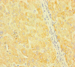 Immunohistochemistry of paraffin-embedded human liver tissue using the antibody at dilution of 1:100Rabbit anti-Human SNX14 Polyclonal Antibody
