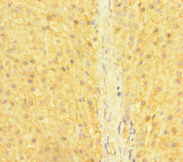 Immunohistochemistry of paraffin-embedded human adrenal gland tissue using SNX14 Antibody at dilution of 1:100Rabbit anti-Human SNX14 Polyclonal Antibody