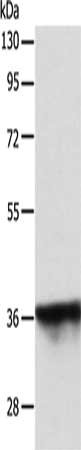 Gel: 10%SDS-PAGE, Lysate: 40 μg, Lane: MCF7 cells, Primary antibody: SPATA2L Antibody(SPATA2L Antibody) at dilution 1/500, Secondary antibody: Goat anti rabbit IgG at 1/8000 dilution, Exposure time: 30 secondsRabbit anti-Human SPATA2L Polyclonal Antibody