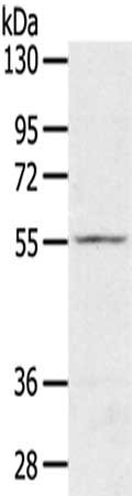 Gel: 8%SDS-PAGE,Lysate: 40 μg,,Primary antibody: SLC16A11 Antibody(SLC16A11 Antibody) at dilution 1/200 dilution,Secondary antibody: Goat anti rabbit IgG at 1/8000 dilution,Exposure time: 2 minutesRabbit anti-Human SLC16A11 Polyclonal Antibody