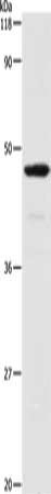 Gel: 10%SDS-PAGE, Lysate: 30 μg, Lane: HepG2 cells, Primary antibody: SERPINA3 Antibody(SERPINA3 Antibody) at dilution 1/250, Secondary antibody: Goat anti rabbit IgG at 1/8000 dilution, Exposure time: 30 secondsRabbit anti-Human SERPINA3 Polyclonal Antibody