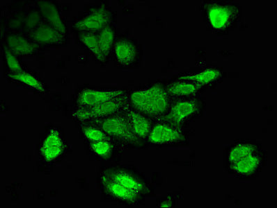 Immunofluorescent analysis of HepG2 cells using TPH2 Antibody at dilution of 1:100 and Alexa Fluor 488-congugated AffiniPure Goat Anti-Rabbit IgG(H+L)Rabbit anti-Human TPH2 Polyclonal Antibody