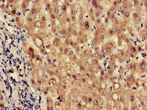 Immunohistochemistry of paraffin-embedded human liver tissue using the antibody at dilution of 1:100Rabbit anti-Human TPH2 Polyclonal Antibody