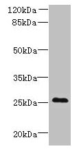 Western blot  | All lanes: C11orf53 antibody at 0.8µg/ml + Mouse gonadal tissue  | Secondary  | Goat polyclonal to rabbit IgG at 1/10000 dilution  | Predicted band size: 26 kDa  | Observed band size: 26 kDa