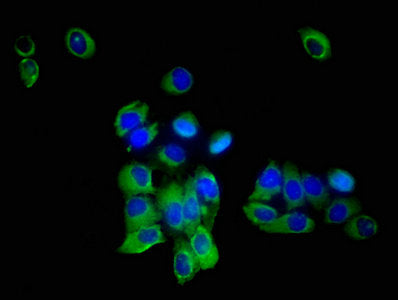 Immunofluorescent analysis of A549 cells using SLC35F2 Antibody at dilution of 1:100 and Alexa Fluor 488-congugated AffiniPure Goat Anti-Rabbit IgG(H+L)Rabbit anti-Human SLC35F2 Polyclonal Antibody