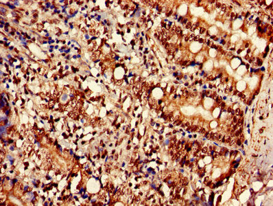 Immunohistochemistry of paraffin-embedded human small intestine tissue using the antibody at dilution of 1:100Rabbit anti-Human SLC35F2 Polyclonal Antibody