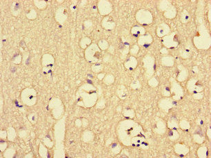 Immunohistochemistry of paraffin-embedded human brain tissue using CKAP2L Antibody at dilution of 1:100Rabbit anti-Human CKAP2L Polyclonal Antibody