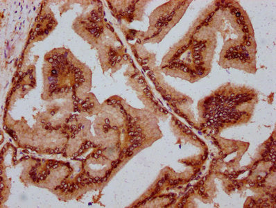IHC image of MAML2 Antibody diluted at 1:800 and staining in paraffin-embedded human prostate tissue performed on a Leica BondTM system. After dewaxing and hydration, antigen retrieval was mediated by high pressure in a citrate buffer (pH 6.0). Section was blocked with 10% normal goat serum 30min at RT. Then primary antibody (1% BSA) was incubated at 4°C overnight. The primary is detected by a biotinylated secondary antibody and visualized using an HRP conjugated SP system.