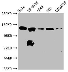 Western Blot | Positive WB detected in: Hela whole cell lysate, SH-SY5Y whole cell lysate, A549 whole cell lysate, PC-3 whole cell lysate, COLO320 whole cell lysate | All lanes: MAML2 antibody at 2.2μg/ml | Secondary | Goat polyclonal to rabbit IgG at 1/50000 dilution | Predicted band size: 126 kDa | Observed band size: 126 kDa