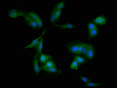 Immunofluorescent analysis of Hela cells using WDFY3 Antibody at dilution of 1:100 and Alexa Fluor 488-congugated AffiniPure Goat Anti-Rabbit IgG(H+L)Rabbit anti-Human WDFY3 Polyclonal Antibody