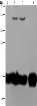 Gel: 10%SDS-PAGE, Lysate: 40 μg, Lane 1-4: A549 cells, K562 cells, Raji cells, human fetal intestine tissue, Primary antibody: IL17C Antibody(IL17C Antibody) at dilution 1/250, Secondary antibody: Goat anti rabbit IgG at 1/8000 dilution, Exposure time: 20 secondsRabbit anti-Human IL17C Polyclonal Antibody