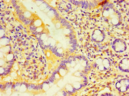 Immunohistochemistry of paraffin-embedded human small intestine tissue using DCP2 Antibody at dilution of 1:100Rabbit anti-Human DCP2 Polyclonal Antibody