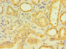 Immunohistochemistry of paraffin-embedded human kidney tissue using DCP2 Antibody at dilution of 1:100Rabbit anti-Human DCP2 Polyclonal Antibody