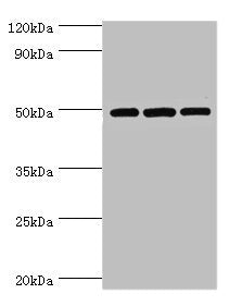 Western blot | All lanes: m7GpppN-mRNA hydrolase antibody at 7μg/ml | Lane 1: Hela whole cell lysate | Lane 2: Jurkat whole cell lysate | Lane 3: 293T whole cell lysate | Secondary | Goat polyclonal to rabbit IgG at 1/10000 dilution | Predicted band size: 49, 45 kDa | Observed band size: 49 kDaRabbit anti-Human DCP2 Polyclonal Antibody