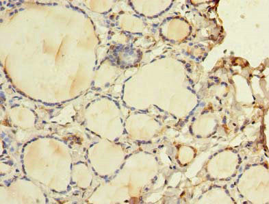 Immunohistochemistry of paraffin-embedded human thyroid tissue using WDR49 Antibody at dilution of 1:100Rabbit anti-Human WDR49 Polyclonal Antibody