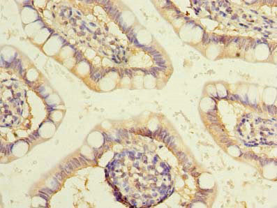 Immunohistochemistry of paraffin-embedded human small intestine tissue using WDR49 Antibody at dilution of 1:100Rabbit anti-Human WDR49 Polyclonal Antibody