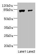 Western blot  | All lanes: WDR49 antibody at 7µg/ml  | Lane 1: A549 whole cell lysate  | Lane 2: Hela whole cell lysate  | Secondary  | Goat polyclonal to rabbit IgG at 1/10000 dilution  | Predicted band size: 80, 60 kDa  | Observed band size: 80 kDaRabbit anti-Human WDR49 Polyclonal Antibody