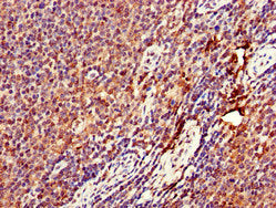 Immunohistochemistry of paraffin-embedded human lymph node tissue using DENND1C Antibody at dilution of 1:100Rabbit anti-Human DENND1C Polyclonal Antibody