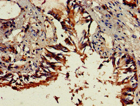 Immunohistochemistry of paraffin-embedded human lung tissue using DENND1C Antibody at dilution of 1:100Rabbit anti-Human DENND1C Polyclonal Antibody
