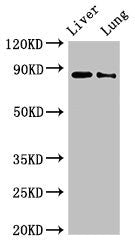 Western Blot | Positive WB detected in: Rat liver tissue, Rat lung tissue | All lanes: DENND1C antibody at 3μg/ml | Secondary | Goat polyclonal to rabbit IgG at 1/50000 dilution | Predicted band size: 88, 83 kDa | Observed band size: 88 kDaRabbit anti-Human DENND1C Polyclonal Antibody