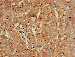 Immunohistochemistry of paraffin-embedded human heart tissue using SULF2 Antibody at dilution of 1:100Rabbit anti-Human SULF2 Polyclonal Antibody