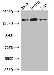 Western Blot | Positive WB detected in: Hela whole cell lysate, Mouse brain tissue, Rat lung tissue | All lanes: SULF2 antibody at 2.7μg/ml | Secondary | Goat polyclonal to rabbit IgG at 1/50000 dilution | Predicted band size: 101 kDa | Observed band size: 140 kDaRabbit anti-Human SULF2 Polyclonal Antibody