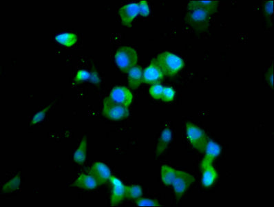 Immunofluorescence staining of SH-SY5Y cells with CDAN1 Antibody at 1:100, counter-stained with DAPI. The cells were fixed in 4% formaldehyde, permeabilized using 0.2% Triton X-100 and blocked in 10% normal Goat Serum. The cells were then incubated with the antibody overnight at 4°C. The secondary antibody was Alexa Fluor 488-congugated AffiniPure Goat Anti-Rabbit IgG(H+L).Rabbit anti-Human CDAN1 Polyclonal Antibody