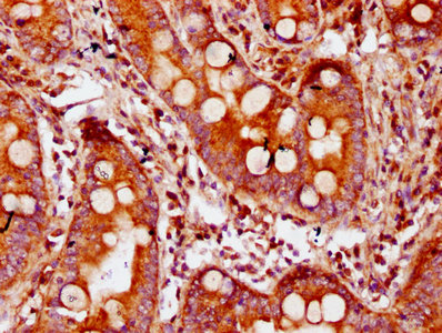 IHC image of CDAN1 Antibody diluted at 1:300 and staining in paraffin-embedded human small intestine tissue performed on a Leica BondTM system. After dewaxing and hydration, antigen retrieval was mediated by high pressure in a citrate buffer (pH 6.0). Section was blocked with 10% normal goat serum 30min at RT. Then primary antibody (1% BSA) was incubated at 4°C overnight. The primary is detected by a biotinylated secondary antibody and visualized using an HRP conjugated SP system.Rabbit anti-Human CDAN1 Polyclonal Antibody