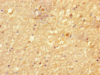 Immunohistochemistry of paraffin-embedded human brain tissue using NIM1K Antibody at dilution of 1:100Rabbit anti-Human NIM1K Polyclonal Antibody