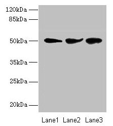 Western blot  | All lanes: NIM1K antibody at 2µg/ml  | Lane 1: Jurkat whole cell lysate  | Lane 2: HepG2 whole cell lysate  | Lane 3: COLO205 whole cell lysate  | Secondary  | Goat polyclonal to rabbit IgG at 1/10000 dilution  | Predicted band size: 50 kDa  | Observed band size: 50 kDaRabbit anti-Human NIM1K Polyclonal Antibody