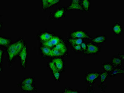 Immunofluorescent analysis of Hela cells using FAM71A Antibody at dilution of 1:100 and Alexa Fluor 488-congugated AffiniPure Goat Anti-Rabbit IgG(H+L)Rabbit anti-Human FAM71A Polyclonal Antibody