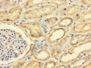Immunohistochemistry of paraffin-embedded human kidney tissue using the antibody at dilution of 1:100Rabbit anti-Human FAM71A Polyclonal Antibody