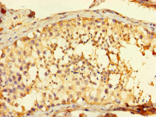 Immunohistochemistry of paraffin-embedded human testis tissue using FAM71A Antibody at dilution of 1:100Rabbit anti-Human FAM71A Polyclonal Antibody