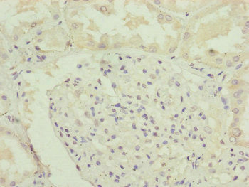 Immunohistochemistry of paraffin-embedded human kidney tissue using RNF135 Antibody at dilution of 1:100Rabbit anti-Human RNF135 Polyclonal Antibody