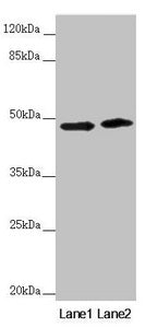 Western blot  | All lanes: RNF135 antibody at 3.51µg/ml  | Lane 1: 293T whole cell lysate  | Lane 2: Jurkat whole cell lysate  | Secondary  | Goat polyclonal to rabbit IgG at 1/10000 dilution  | Predicted band size: 48, 23, 31 kDa  | Observed band size: 48 kDaRabbit anti-Human RNF135 Polyclonal Antibody