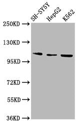 Western Blot  | Positive WB detected in: SH-SY5Y whole cell lysate, HepG2 whole cell lysate, K562 whole cell lysate  | All lanes: ULK2 antibody at 2.9µg/ml  | Secondary  | Goat polyclonal to rabbit IgG at 1/50000 dilution  | Predicted band size: 113 kDa  | Observed band size: 113 kDaRabbit anti-Human ULK2 Polyclonal Antibody