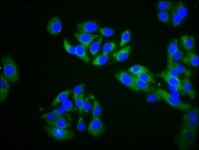 Immunofluorescence staining of HepG2 cells with ZDHHC14 Antibody at 1:200, counter-stained with DAPI. The cells were fixed in 4% formaldehyde, permeabilized using 0.2% Triton X-100 and blocked in 10% normal Goat Serum. The cells were then incubated with the antibody overnight at 4°C. The secondary antibody was Alexa Fluor 488-congugated AffiniPure Goat Anti-Rabbit IgG(H+L).Rabbit anti-Human ZDHHC14 Polyclonal Antibody