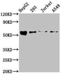 Western Blot  | Positive WB detected in: HepG2 whole cell lysate, 293 whole cell lysate, Jurkat whole cell lysate, A549 whole cell lysate  | All lanes: ZDHHC14 antibody at 10.5µg/ml  | Secondary  | Goat polyclonal to rabbit IgG at 1/50000 dilution  | Predicted band size: 54, 52 kDa  | Observed band size: 54 kDaRabbit anti-Human ZDHHC14 Polyclonal Antibody