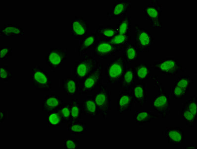 Immunofluorescence staining of A549 cells with AHNAK2 Antibody at 1:133, counter-stained with DAPI. The cells were fixed in 4% formaldehyde, permeabilized using 0.2% Triton X-100 and blocked in 10% normal Goat Serum. The cells were then incubated with the antibody overnight at 4°C. The secondary antibody was Alexa Fluor 488-congugated AffiniPure Goat Anti-Rabbit IgG(H+L).Rabbit anti-Human AHNAK2 Polyclonal Antibody