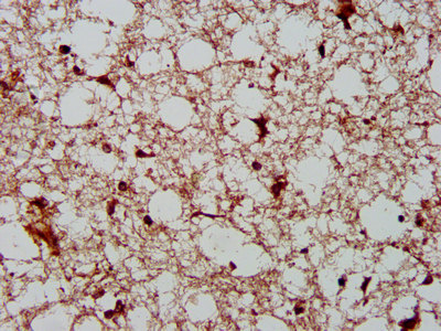 IHC image of AHNAK2 Antibody diluted at 1:400 and staining in paraffin-embedded human brain tissue performed on a Leica BondTM system. After dewaxing and hydration, antigen retrieval was mediated by high pressure in a citrate buffer (pH 6.0). Section was blocked with 10% normal goat serum 30min at RT. Then primary antibody (1% BSA) was incubated at 4°C overnight. The primary is detected by a biotinylated secondary antibody and visualized using an HRP conjugated SP system.Rabbit anti-Human AHNAK2 Polyclonal Antibody