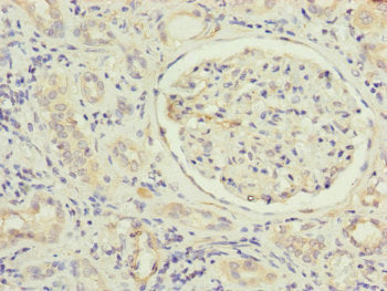 Immunohistochemistry of paraffin-embedded human kidney tissue using MFN1 Antibody at dilution of 1:100