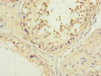 Immunohistochemistry of paraffin-embedded human testis tissue using MFN1 Antibody at dilution of 1:100