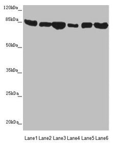 Western blot  | All lanes: MFN1 antibody at 3.78µg/ml  | Lane 1: Human placenta tissue  | Lane 2: Mouse kidney tissue  | Lane 3: NIH/3T3 whole cell lysate  | Lane 4: Jurkat whole cell lysate  | Lane 5: Hela whole cell lysate  | Lane 6: K562 whole cell lysate  | Secondary  | Goat polyclonal to rabbit IgG at 1/10000 dilution  | Predicted band size: 85, 42, 72 kDa  | Observed band size: 85 kDa