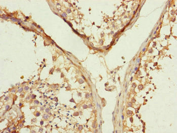Immunohistochemistry of paraffin-embedded human testis tissue using MFN1 Antibody at dilution of 1:100