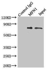 Immunoprecipitating MFN1 in Jurkat whole cell lysate | Lane 1: Rabbit control IgG instead of (1μg) instead of MFN1 Antibody in Jurkat whole cell lysate. | For western blotting, a HRP-conjugated light chain specific antibody was used as the Secondary antibody (1/50000) | Lane 2: MFN1 Antibody (4μg) + Jurkat whole cell lysate (500μg) | Lane 3: Jurkat whole cell lysate (20μg)