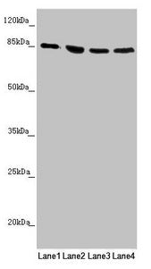 Western blot | All lanes: MFN1 antibody at 1.1μg/ml | Lane 1: Human placenta tissue | Lane 2: Jurkat whole cell lysate | Lane 3: Hela whole cell lysate | Lane 4: K562 whole cell lysate | Secondary | Goat polyclonal to rabbit IgG at 1/10000 dilution | Predicted band size: 85, 42, 72 kDa | Observed band size: 85 kDa