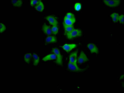 Immunofluorescence staining of MCF-7 cells with ADGRG1 Antibody at 1:133, counter-stained with DAPI. The cells were fixed in 4% formaldehyde, permeabilized using 0.2% Triton X-100 and blocked in 10% normal Goat Serum. The cells were then incubated with the antibody overnight at 4°C. The secondary antibody was Alexa Fluor 488-congugated AffiniPure Goat Anti-Rabbit IgG(H+L).Rabbit anti-Human ADGRG1 Polyclonal Antibody