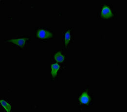 Immunofluorescent analysis of Hela cells using CBWD2 Antibody at dilution of 1:100 and Alexa Fluor 488-congugated AffiniPure Goat Anti-Rabbit IgG(H+L)