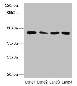 Western Blot  | All lanes: CBWD2 antibody at 6µg/ml  | Lane 1: Mouse heart tissue  | Lane 2: Mouse liver tissue  | Lane 3: Mouse lung tissue  | Lane 4: Hela whole cell lysate  | Secondary  | Goat polyclonal to rabbit IgG at 1/10000 dilution  | Predicted band size: 45 kDa  | Observed band size: 45 kDa